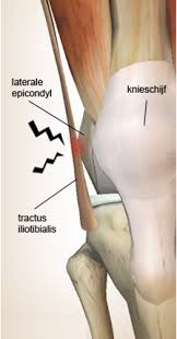 runners-knee